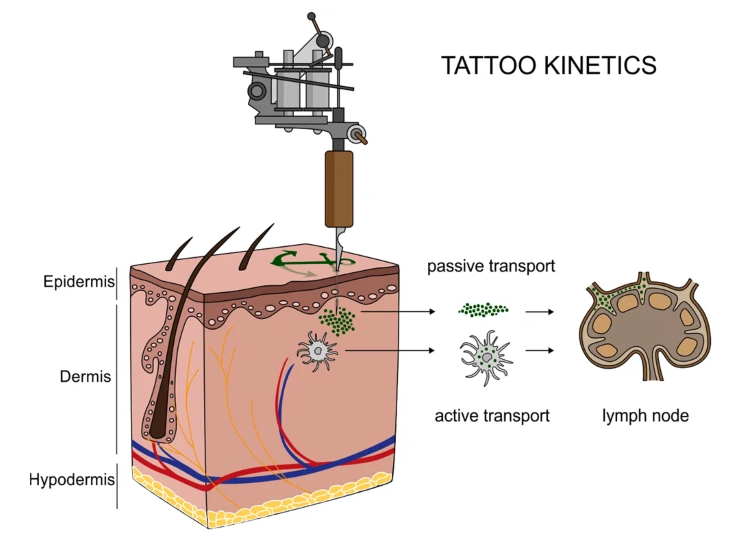 tattoo toxicity